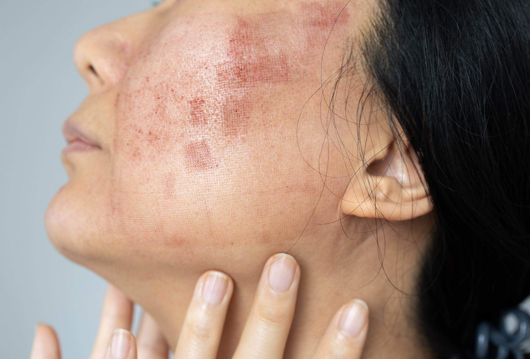 lupus pais vasco